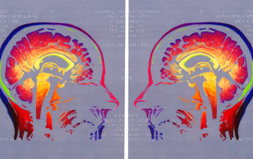 Photo of "Conversations With Myself: Brain Diaries II" an etching artwork of Elizabeth Jameson's brain in rainbow colors.