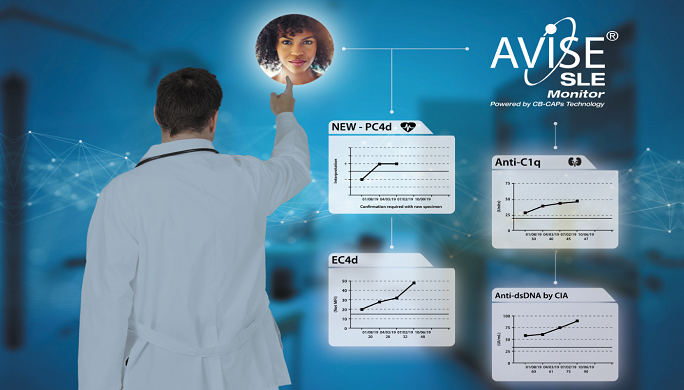 The AVISE SLE Monitor test can help you and your doctor determine if you are in a lupus flare up. 